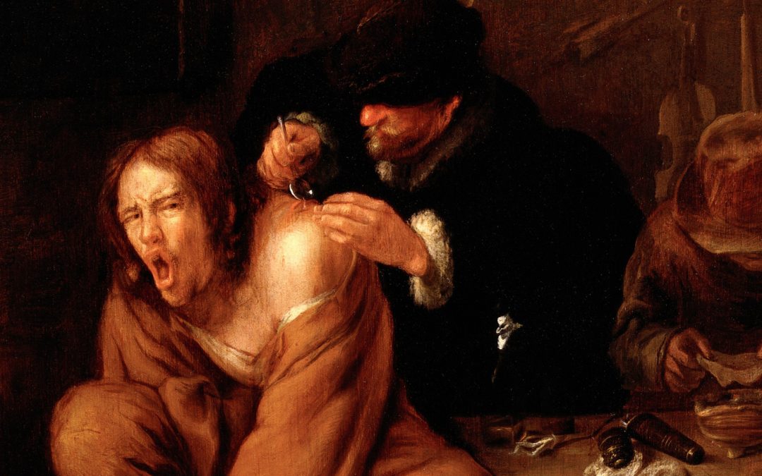 Exposition « Le médecin face à la douleur, 16e-18e siècles » du 11 mars au 18 mai au Musée d&rsquo;Histoire de la Médecine