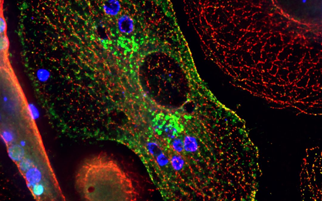 [Atelier – Visite de laboratoire] Microbes : pirates des cellules immunitaires