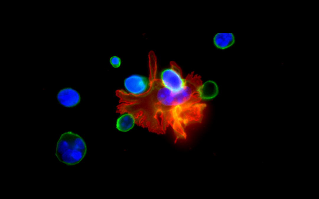 [Atelier-Visite laboratoire] L’immunologie à l’assaut des cancers