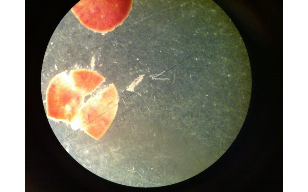 [Atelier] Le rein, filtre de vie