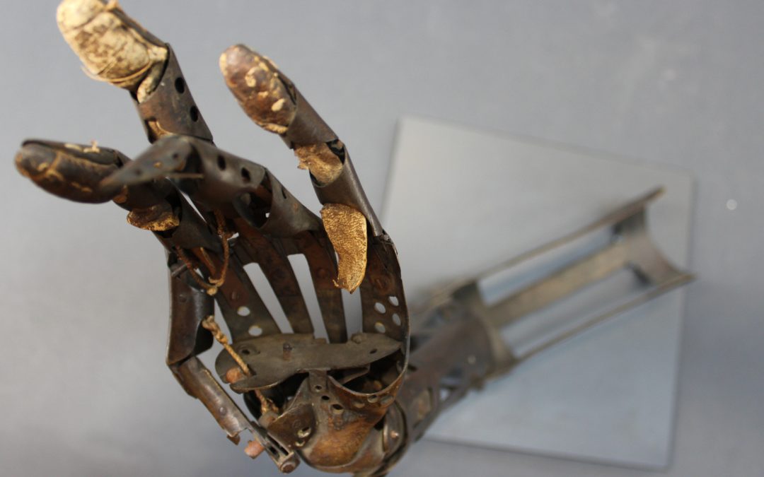 [Exposition] La grande évolution des prothèses de membres