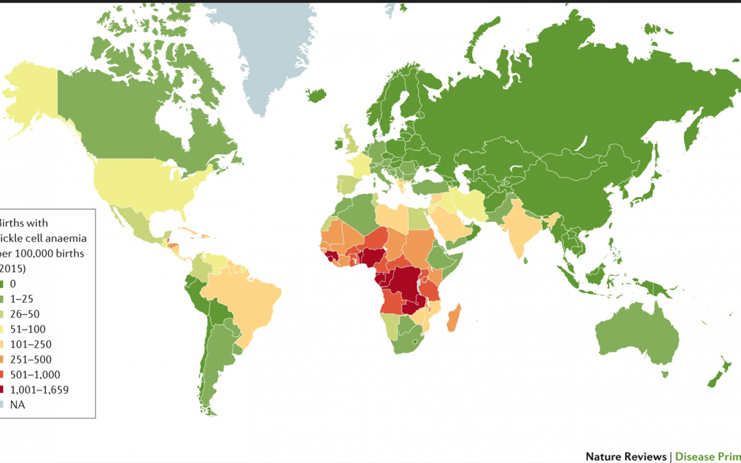 Projet  « drépanocytose : NORD – SUD »  : entretien avec l&rsquo;anthropologue Maria Teixeira