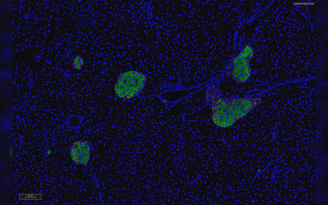 La régulation de la glycémie passe aussi par l’odorat !