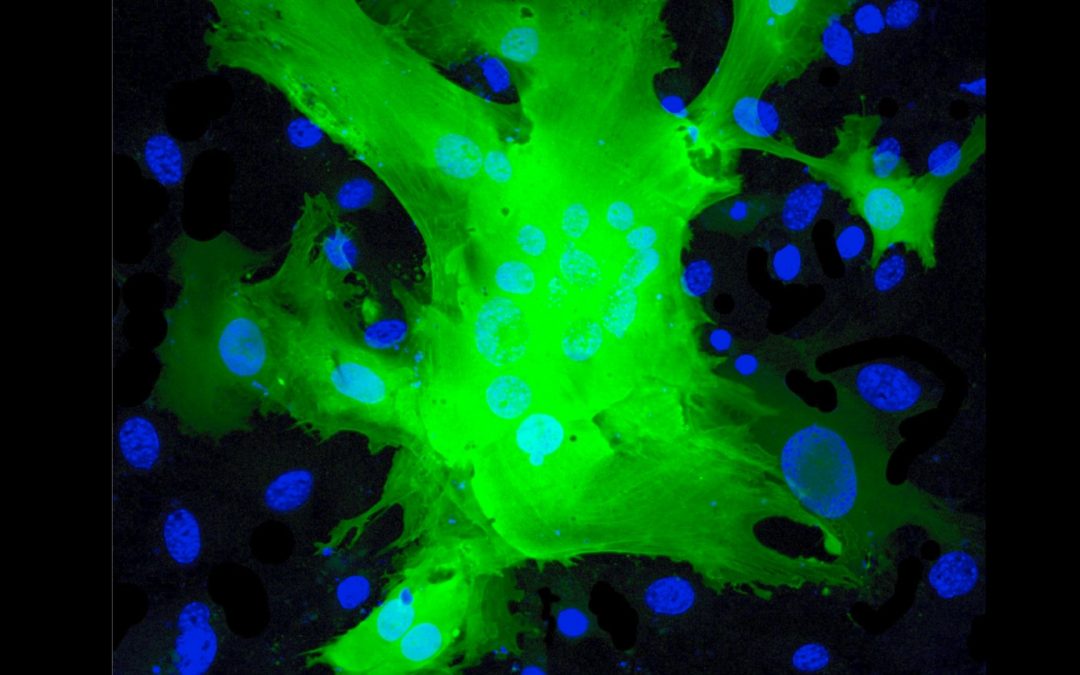 Grossesse pathologique : l’effet de l’interféron