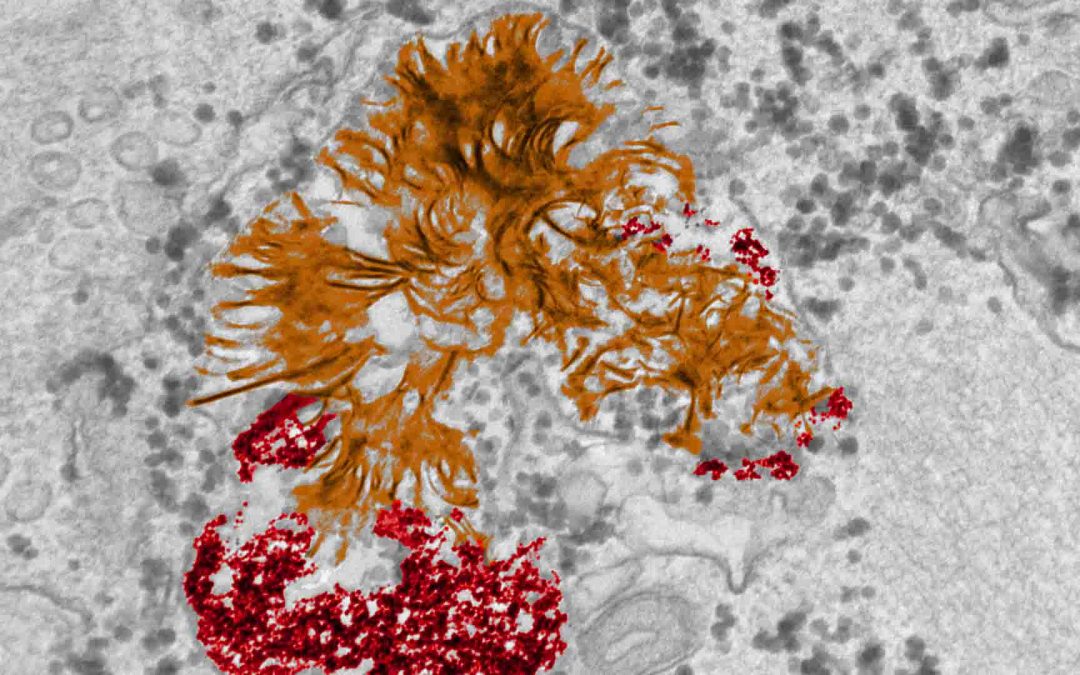 Que deviennent les nanoparticules d’or dans les cellules ?