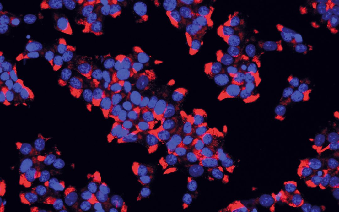 Pour lutter contre le diabète, la flore intestinale livre ses secrets