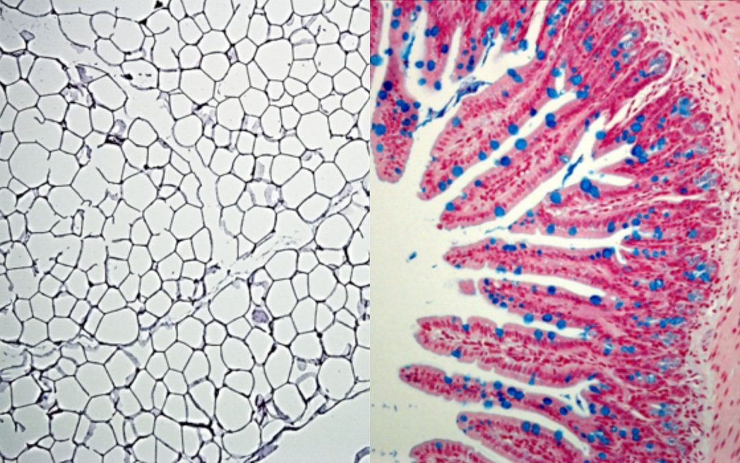 Obésité : des cellules immunitaires associées aux muqueuses intestinales induisent inflammation et dysbiose