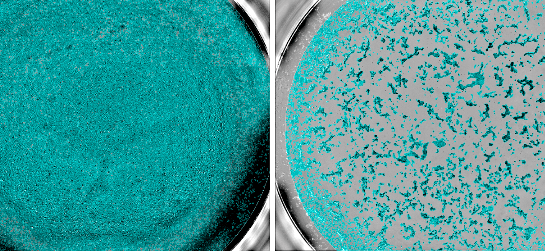 Covid-19 : Évaluation de tests sérologiques de détection d’anticorps