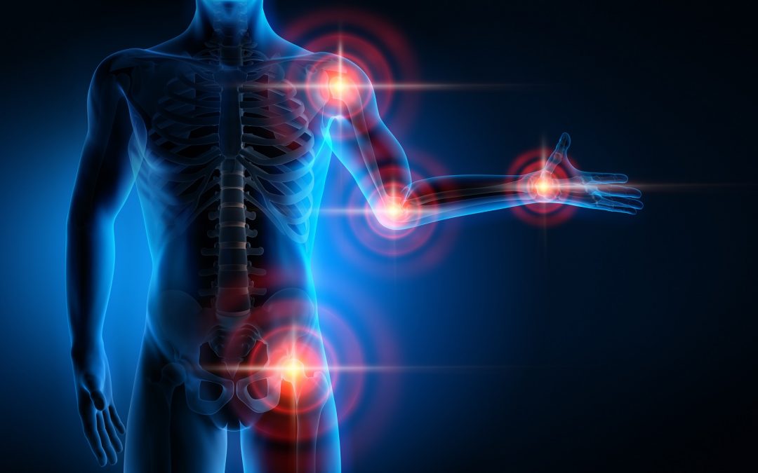 La Faculté de Santé crée l’Institut des Maladies OstéoArticulaires