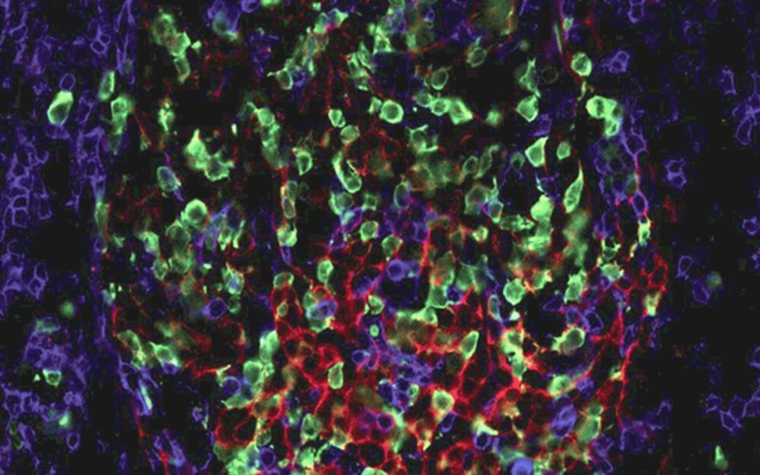 La persistance de cellules mémoires B résistantes au rituximab contribue aux rechutes des patients adultes atteints de thrombopénie immunologique