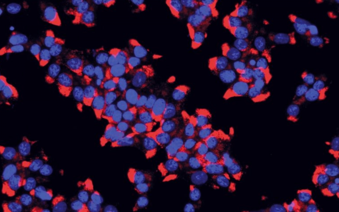Un composé d’origine bactérienne associé à la diversité du microbiote intestinal et à une meilleure santé cardiovasculaire et métabolique