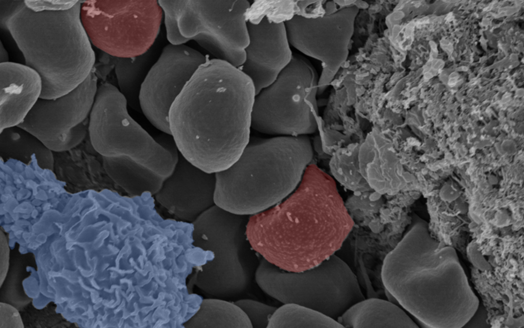 La rate humaine, cimetière et sanctuaire pour le parasite du paludisme