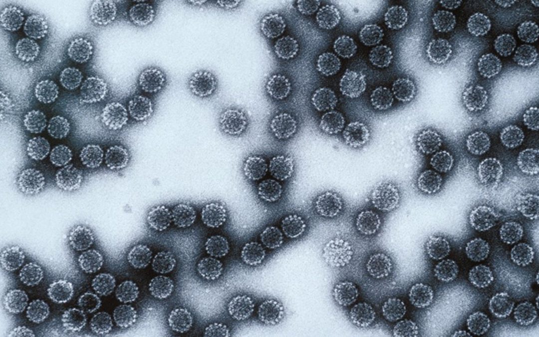 Découverte d’une première cause génétique pour le syndrome de l’homme-arbre