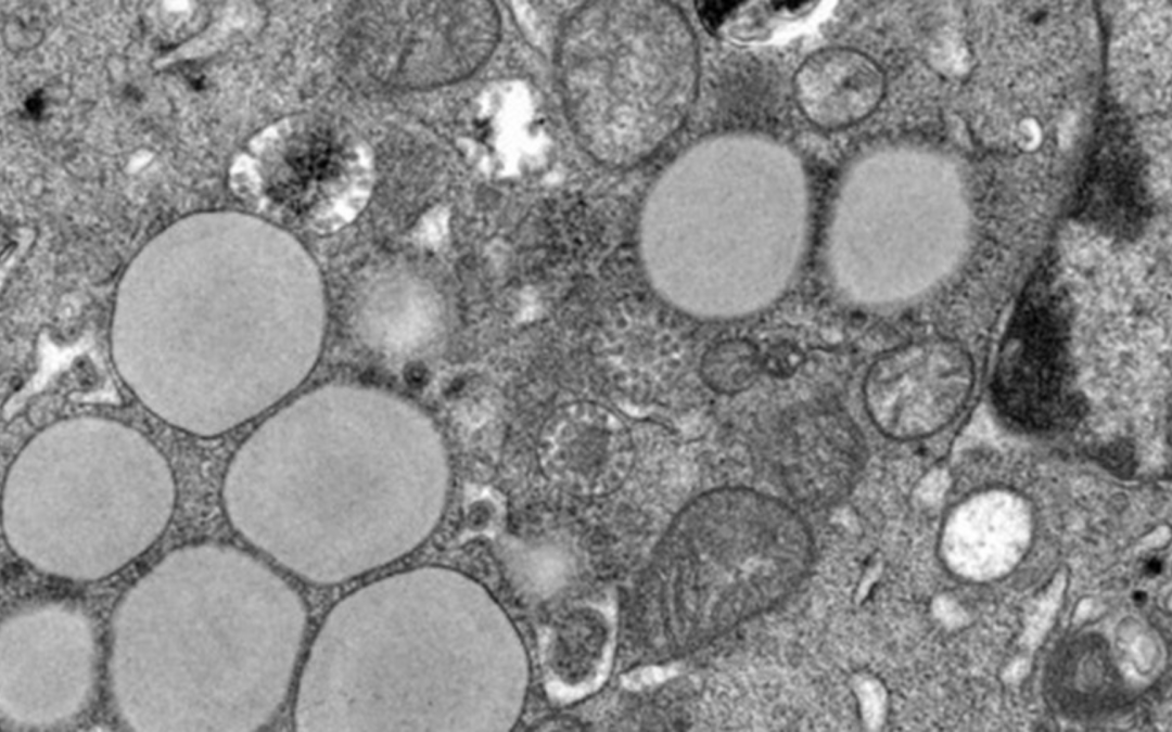 Épuisement du système immunitaire : mieux soigner les cancers et infections chroniques