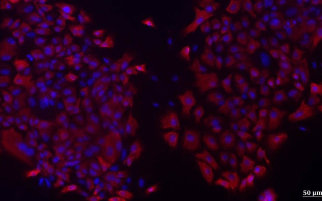 Bronchopneumopathie chronique obstructive : une mutation génétique confirmée comme facteur de prédisposition