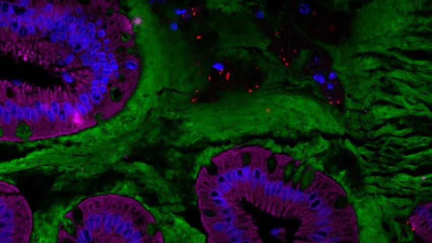 Un additif alimentaire couramment utilisé altèrerait le microbiote et l&rsquo;environnement intestinal humain