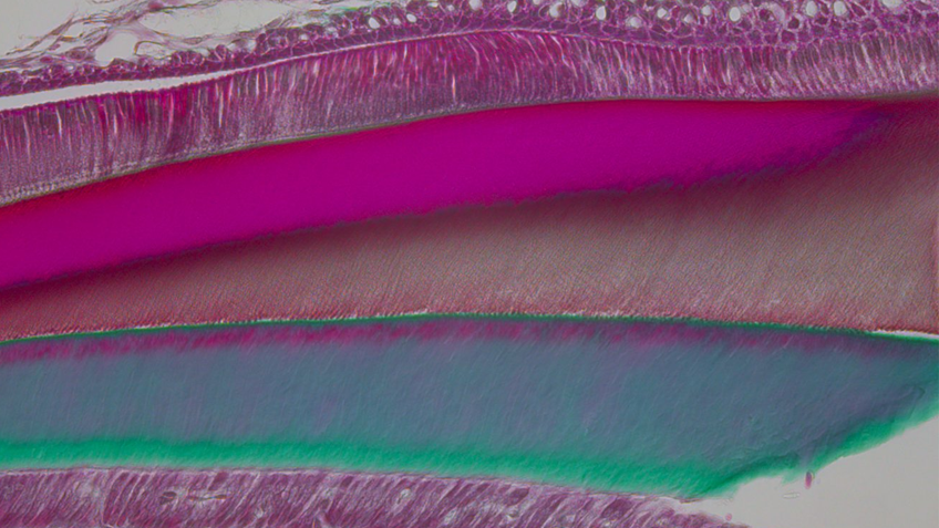 Même à faibles doses, l’exposition au DEHP altère le développement des dents