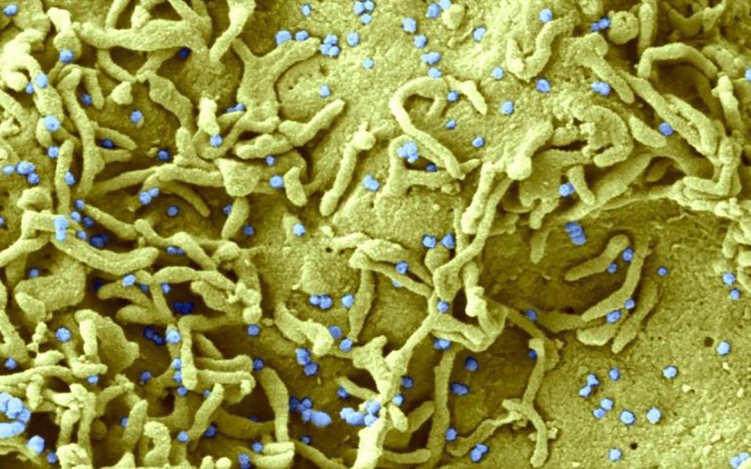 Covid-19 : un déficit immunologique expliquerait près d’un quart des très rares formes sévères observées chez les vaccinés