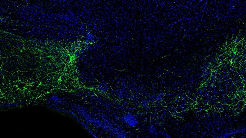 Identification d’une nouvelle voie nerveuse essentielle pour affiner la perception des odeurs