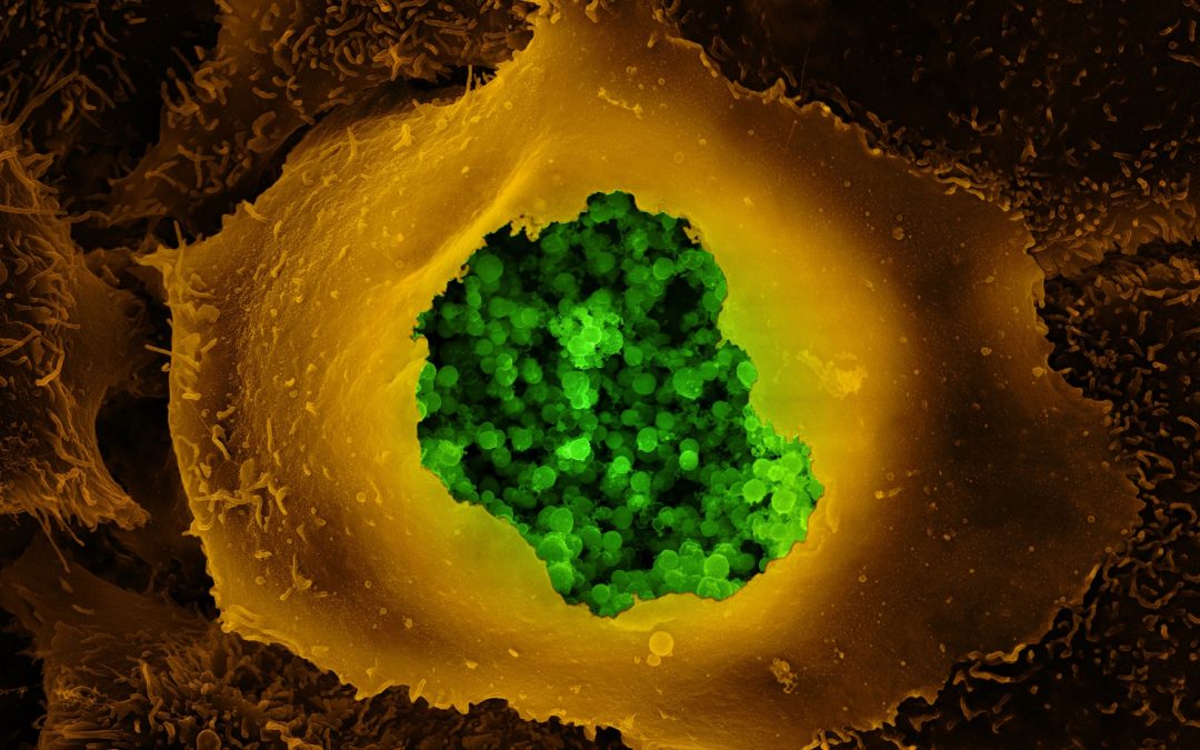 Nouvelles données d’efficacité d’un vaccin contre le méningocoque B et d’un antibiotique préventif pour réduire le risque d&rsquo;IST bactériennes et efficacité démontrée du vaccin MVA-BN contre mpox