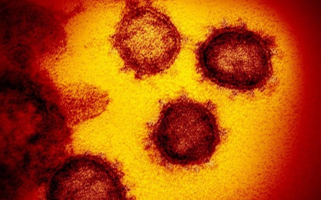 Covid long : la persistance du SARS-CoV-2 dans les muqueuses pourrait être en cause