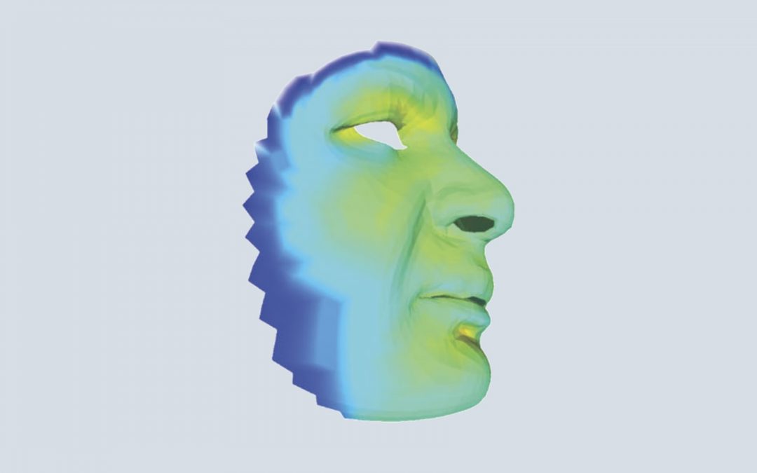 Myohyperplasie hémifaciale : une étude permet de décrire le mécanisme de cette malformation faciale rare et de proposer un traitement médicamenteux