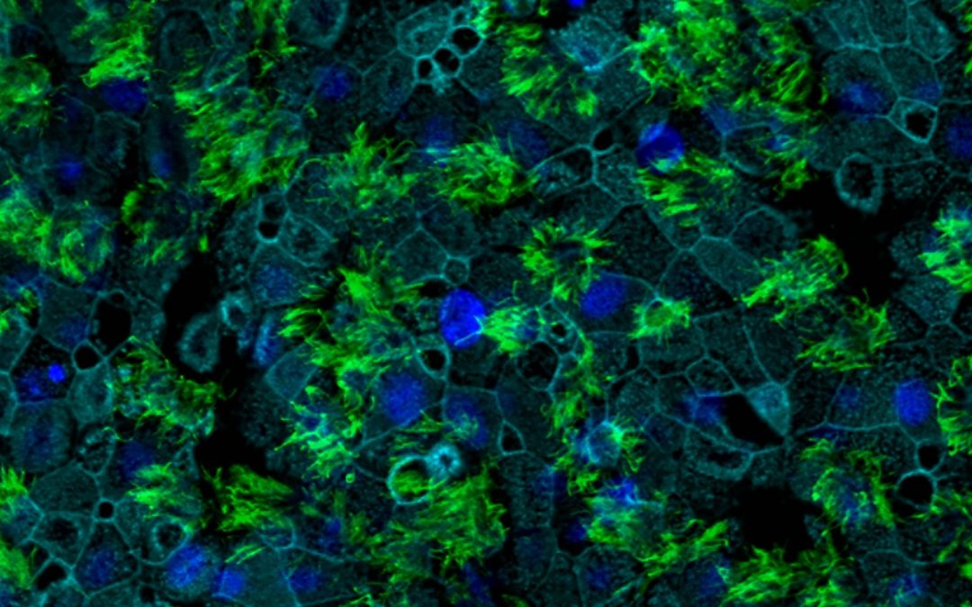 Nouvelle découverte sur les récepteurs d’entrée des coronavirus dans les cellules humaines